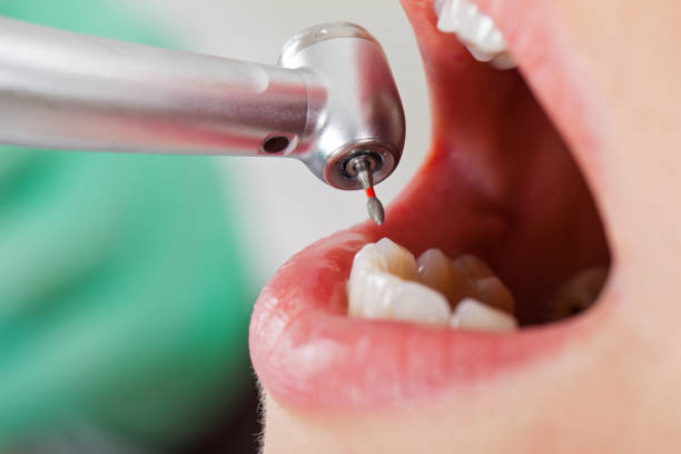 Best Cosmetic Emergency Dentistry in Stanley, ND